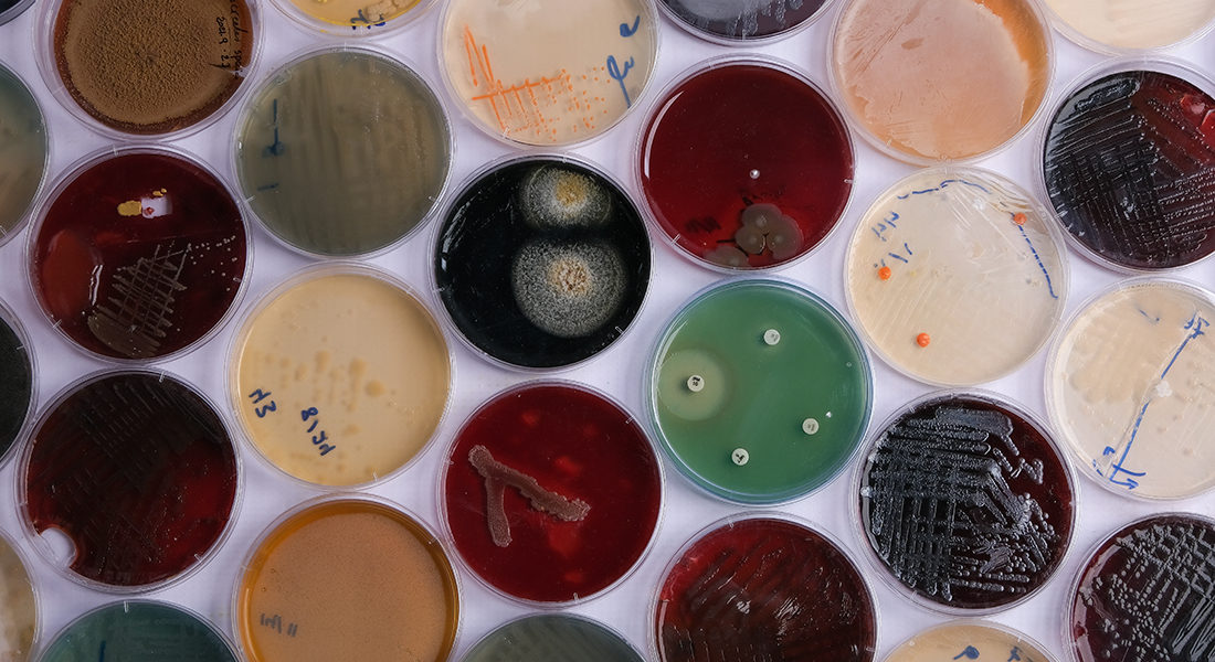 collection of culture plates contain growth of microorganisms on different agar media